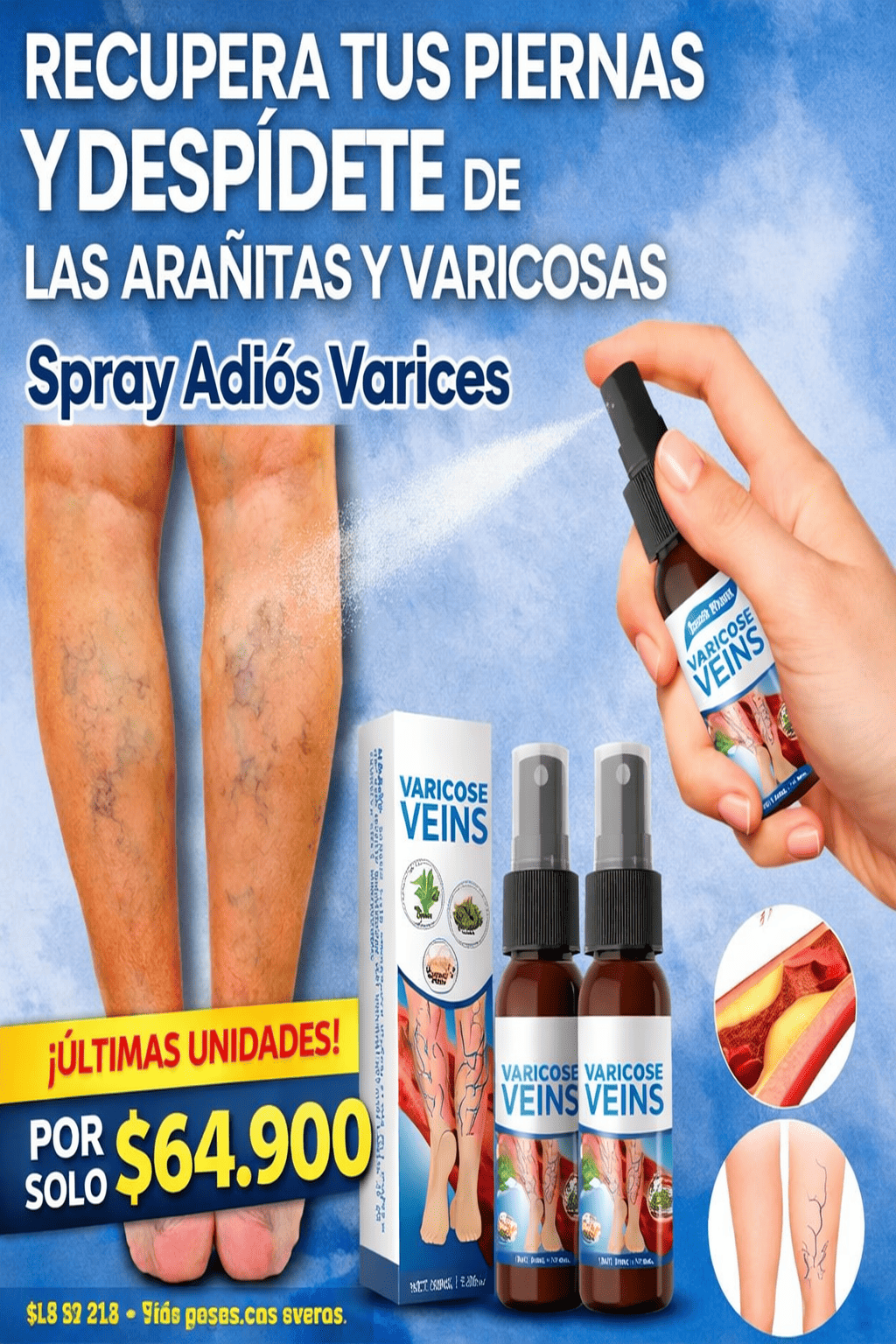 VARICOSE SPRAY™ Alivio diario y cuidado visible para tus piernas.